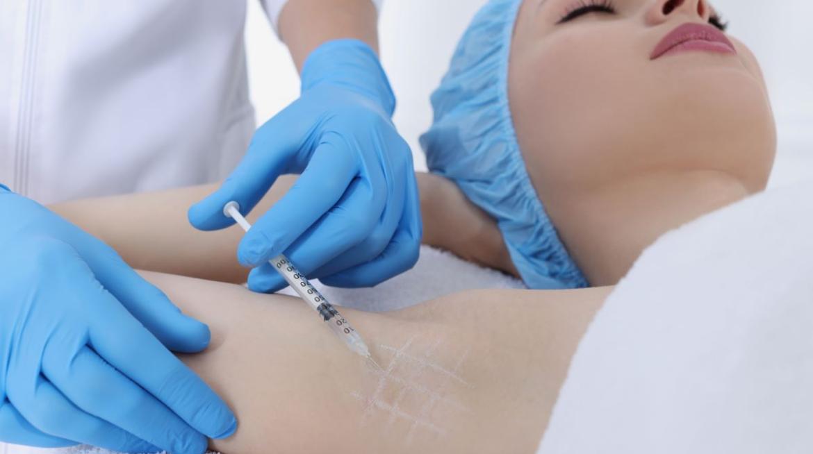 Hiperhidrosis en Valencia Hiperhidrosis en Valencia