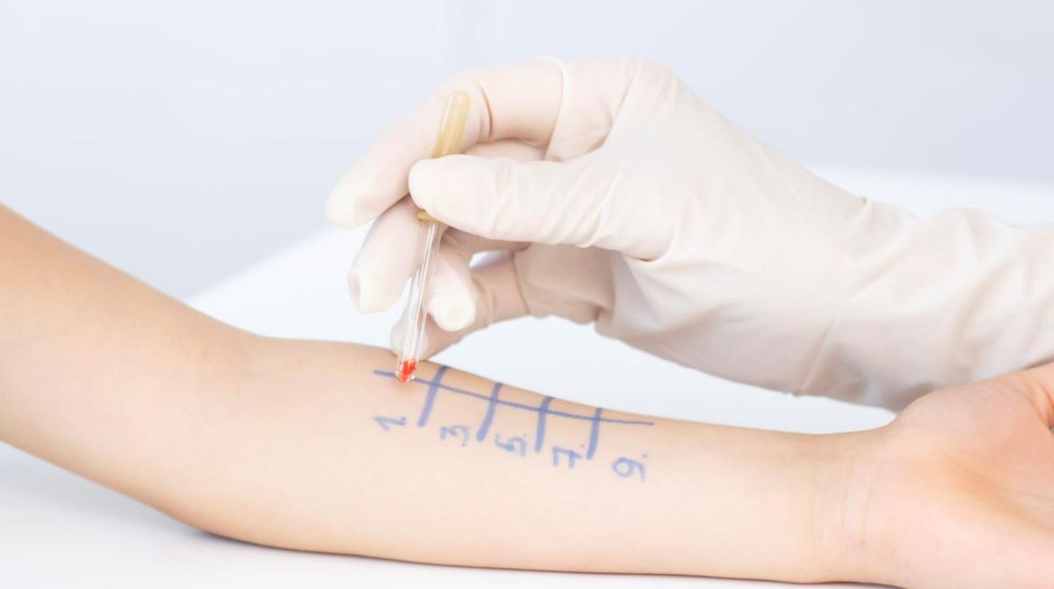 Alergología infantilen valencia