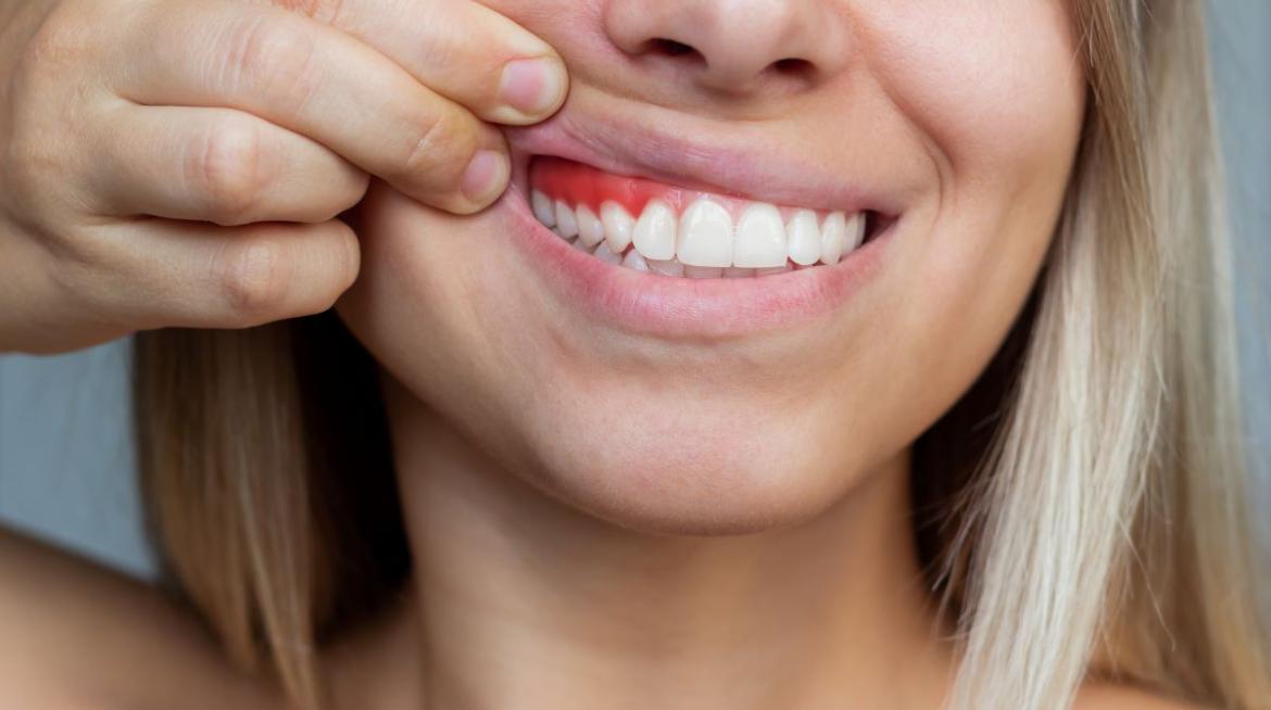 Periodoncia Periodoncia en valencia