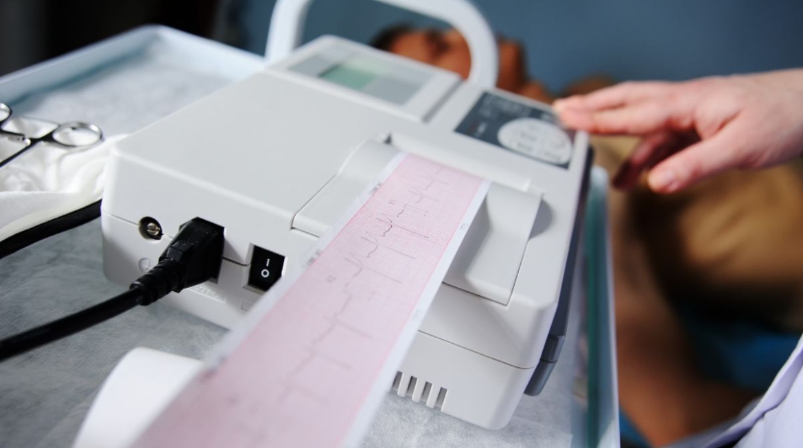 ECG-Electrocardiograma-valencia ECG-Electrocardiograma-valencia