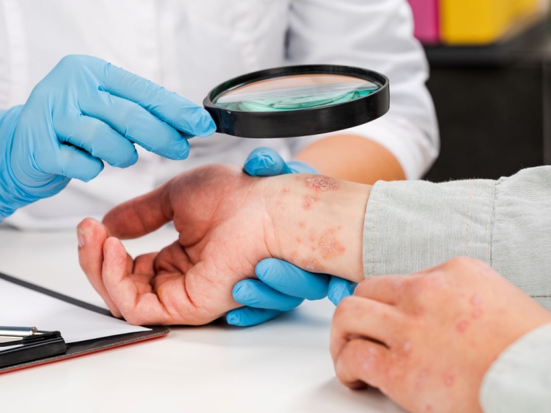 Dermatología Clínica en Valencia Dermatología Clínica en Valencia