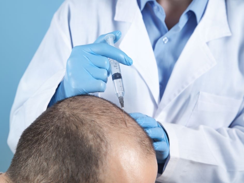 Unidad De Alopecia E Injerto Capilar en Valencia Unidad De Alopecia E Injerto Capilar en Valencia