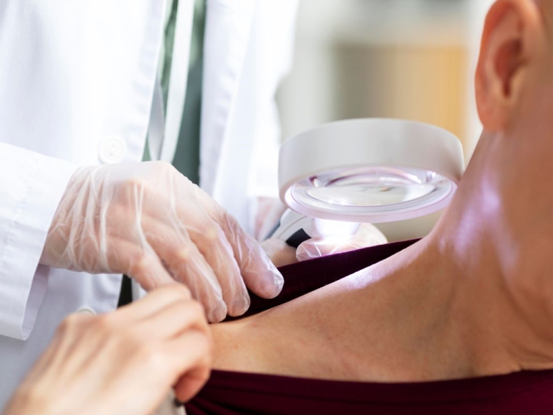 Dermatología Oncológica en valencia Dermatología Oncológica en valencia