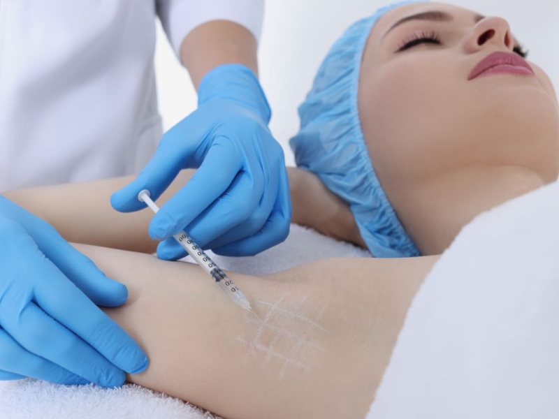 Hiperhidrosis en Valencia Hiperhidrosis en Valencia