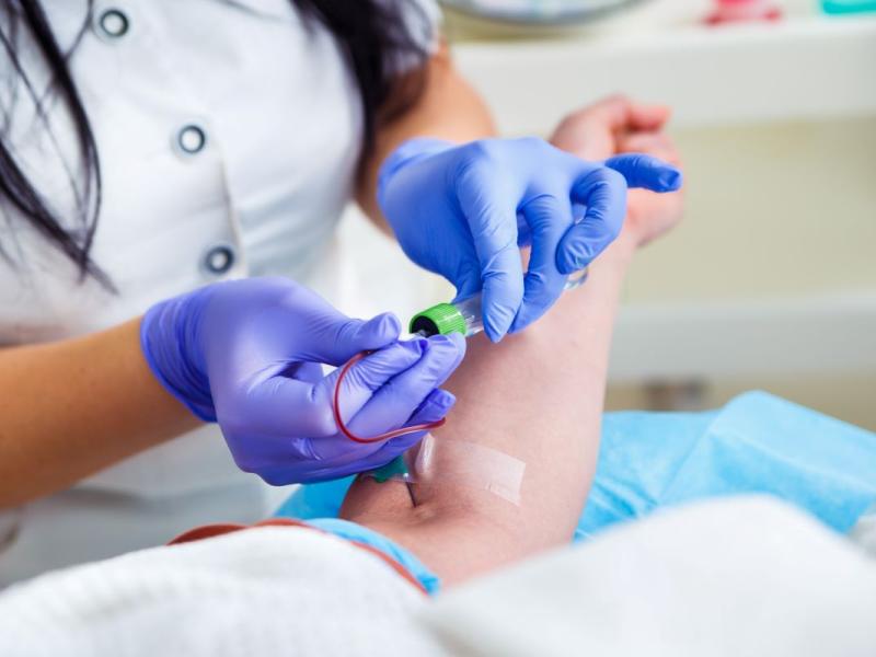 análisis de sangre en Valencia extraccion de sangre en Valencia