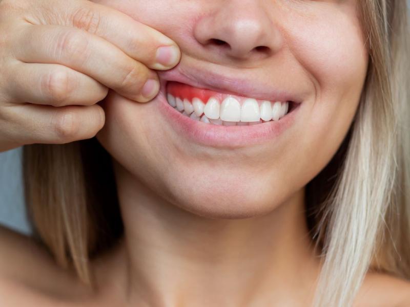 Periodoncia Periodoncia en valencia